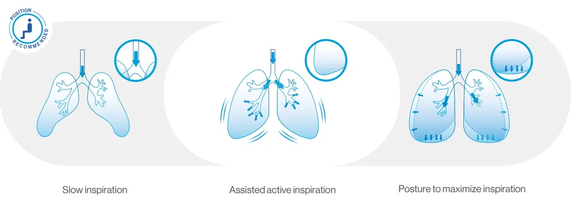 Air-Liquide-EOVETM-70-Electric-Mucus-Suction-Pump-FIG-9