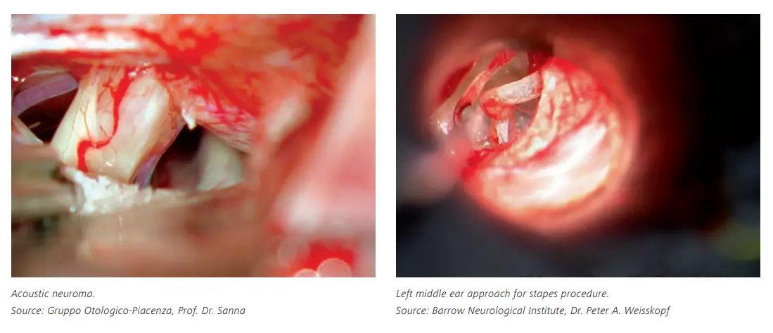 ZEISS S7 OPMI Sensera Surgical Microscope - fig3