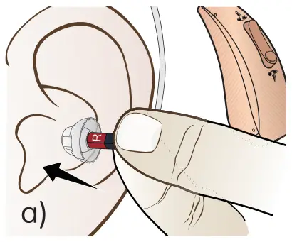 HIONE- B0BTYKSJRB-Rechargeable-Hearing-Aids-with-Noise-Cancelling-fig-11