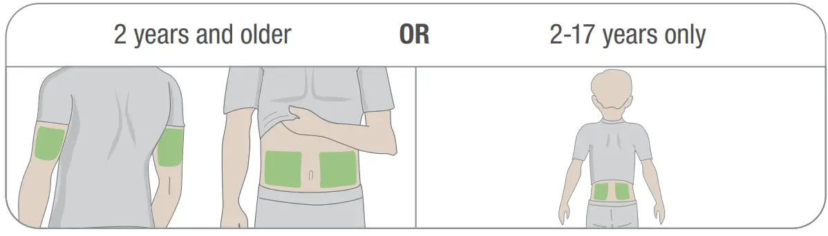 Dexcom G6 CGM Glucose Monitoring System - Fig 21