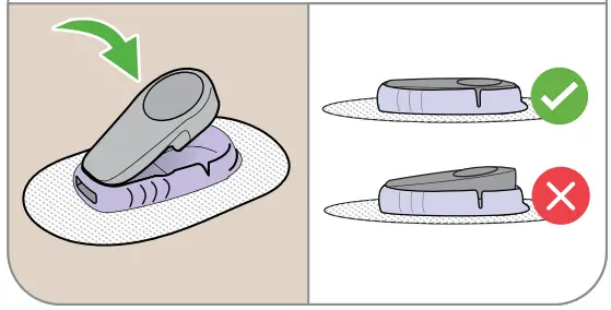 Dexcom G6 CGM Glucose Monitoring System - Fig 34