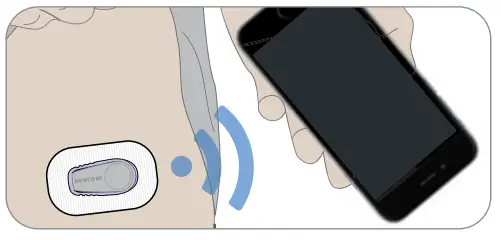 Dexcom G6 CGM Glucose Monitoring System - Fig 4