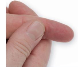 Roche-CoaguChek-XS-System-for-Patient-Self-Testing-fig-11