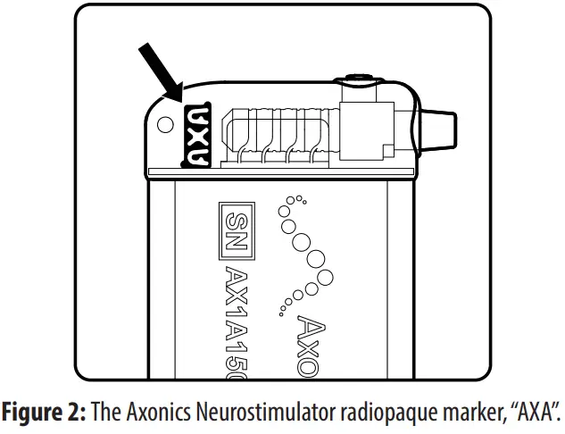 Axonics 1101 Sacral Neuromodulation System - radiopaque marker