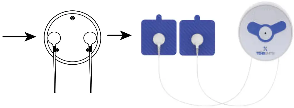 TENS UNITS SM9110 Wireless Muscle Stimulator Device with Remote Control - Package 1