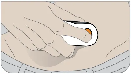 Dexcom G6 Continuous Glucose Monitoring System - insert sensor