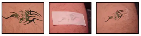 Avance Beauty IPL 350 LS Ultra and Driver - Tattoo