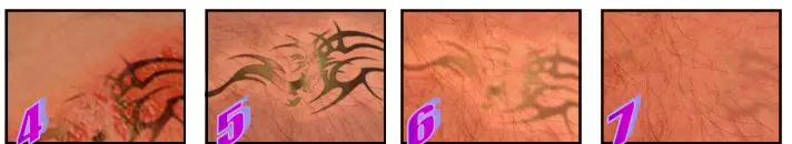 Avance Beauty IPL 350 LS Ultra and Driver - faded