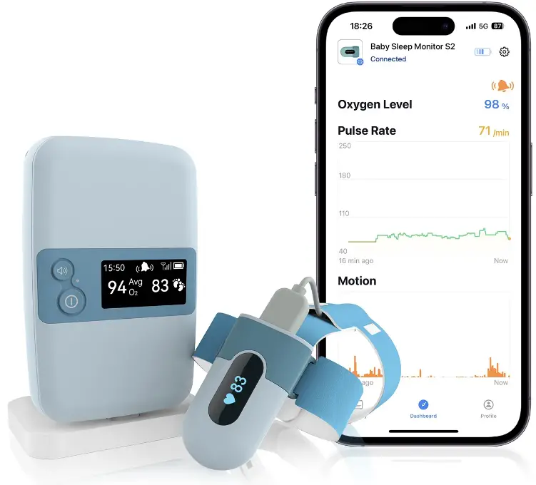 Babytone BM-1T Baby Monitor
