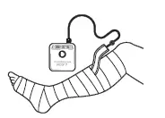 Smith Nephew PICO 7 PICO Single Use Negative Pressure Wound Therapy Systems fig-1