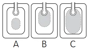 Smith Nephew PICO 7 PICO Single Use Negative Pressure Wound Therapy Systems fig-8
