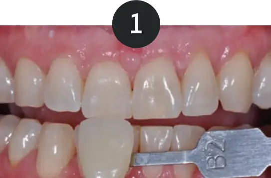 GLO Science PRO POWER+ - Indicates Technique Sensitive Step 1