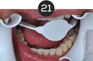 GLO Science PRO POWER+ - Indicates Technique Sensitive Step 21