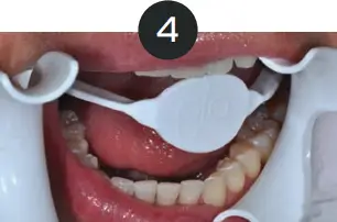 GLO Science PRO POWER+ - Indicates Technique Sensitive Step 4