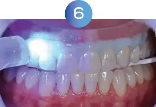 GLO Science PRO POWER+ - Indicates Technique Sensitive Step 6