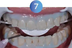 GLO Science PRO POWER+ - Indicates Technique Sensitive Step 7