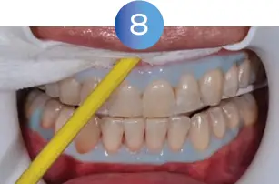 GLO Science PRO POWER+ - Indicates Technique Sensitive Step 8