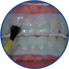 GLO Science PRO POWER+ - Optimal Clinical Outcomes 2