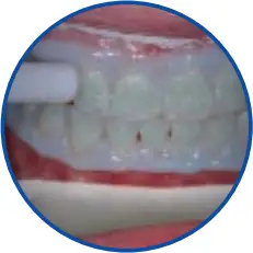 GLO Science PRO POWER+ - Optimal Clinical Outcomes 3