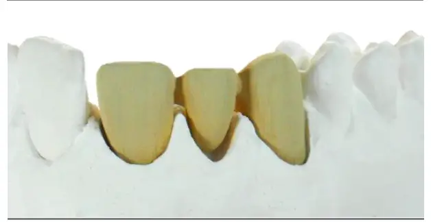 estetic-ceram-ag-0483-EMF-Bonder-3