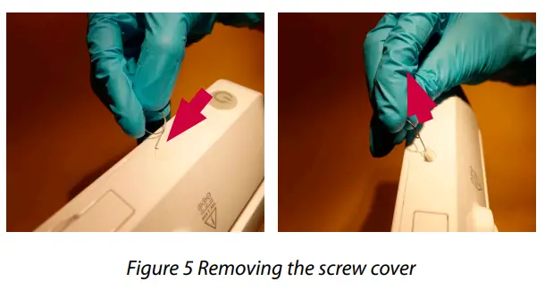 Ambu-aView-2-Advance-Portable-Full-HD-Endoscopy-System-fig-7