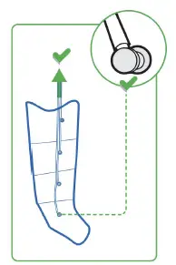 Venen-Engel-6-Premium-Massage-Device-With-Cuff, 6-Deactivable-Air-Chambers-fig- (1)