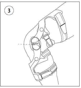 OSSUR-CTi3-Ligament-Knee-Brace-FIG-3