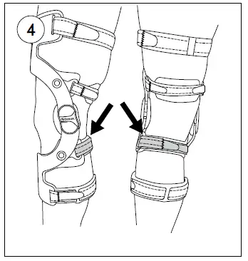 OSSUR-CTi3-Ligament-Knee-Brace-FIG-4
