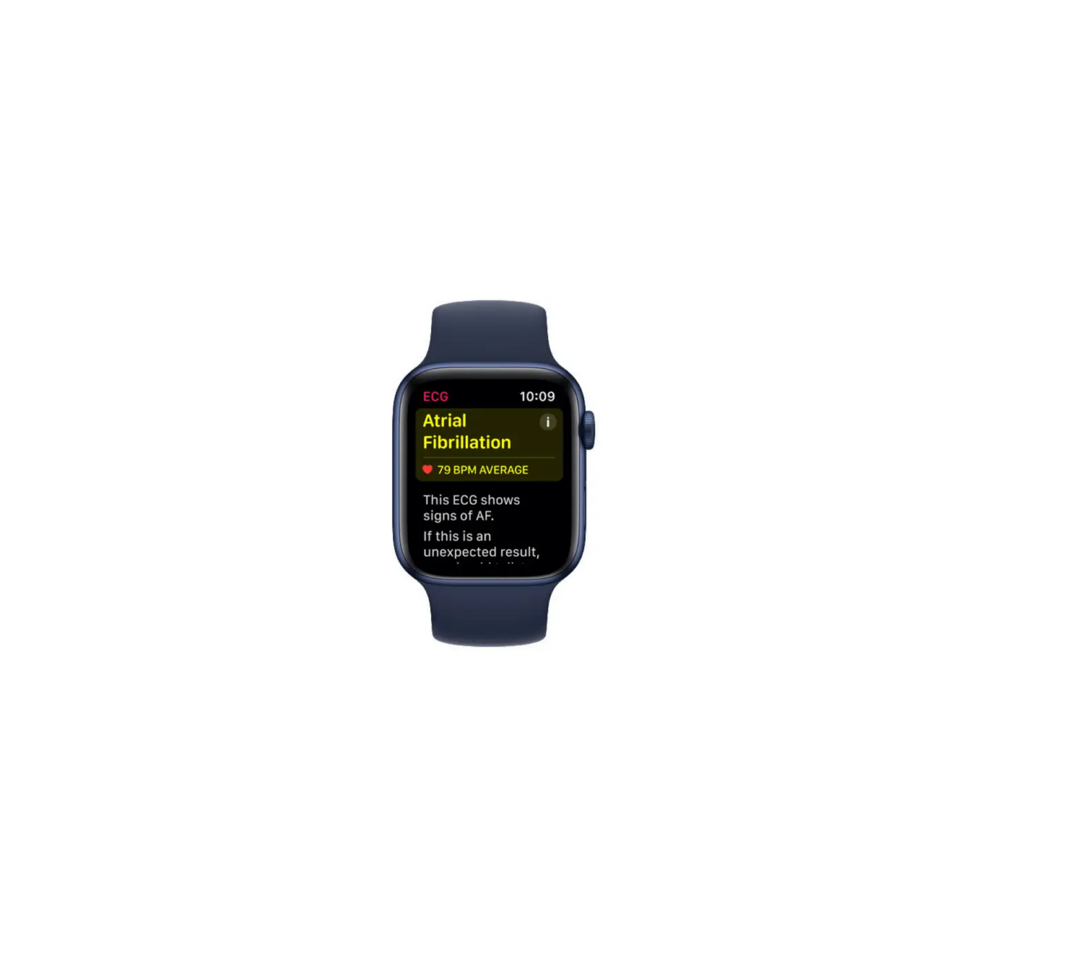 Apple Ecg Smart Watch App Instruction Manual