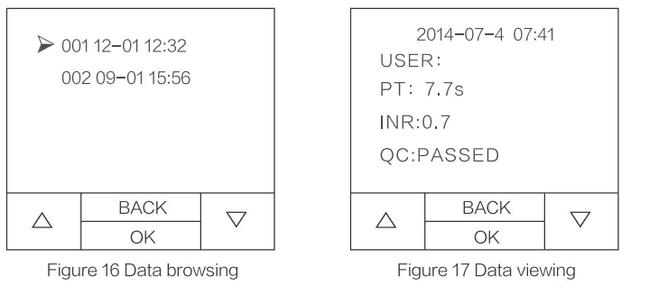 LEPU MEDICAL PT-M1-11 Coagulation Analyzer - data