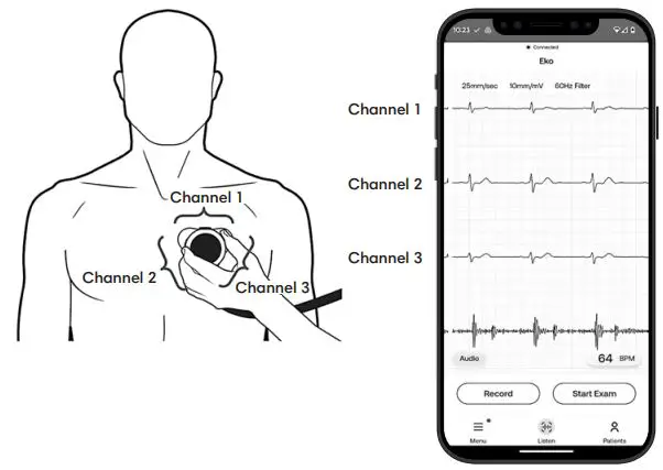 ekohealth-LBL390-Core-500TM-Digital-Stethoscope-FIG- (16)