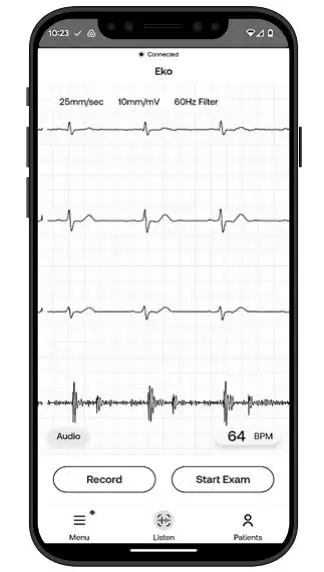 ekohealth-LBL390-Core-500TM-Digital-Stethoscope-FIG- (17)