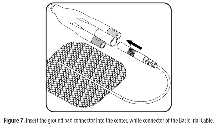 Axonics 1701 PNE Lead Implant Kit-fig-8
