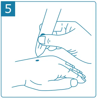 CryoConcepts CryoClear Pen - Fig 5