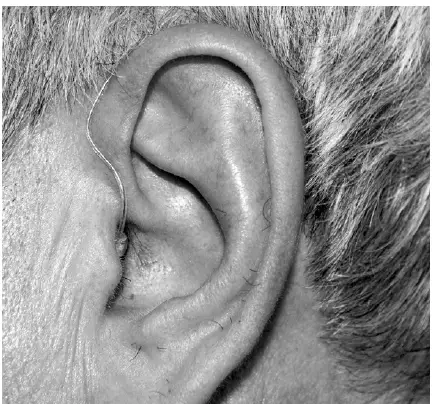 SOUNDWORLD-HD75R-Series-OTC-Hearing-Aid- (5)