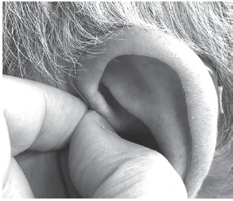 SOUNDWORLD-HD75R-Series-OTC-Hearing-Aid- (6)