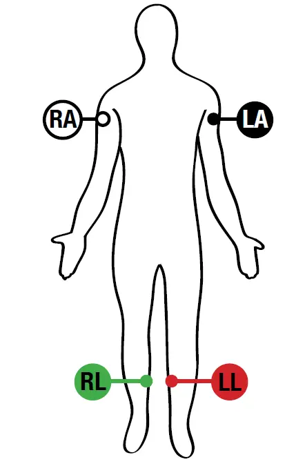 MIDMARK-IQecg-12-Lead-Resting -ECG -01