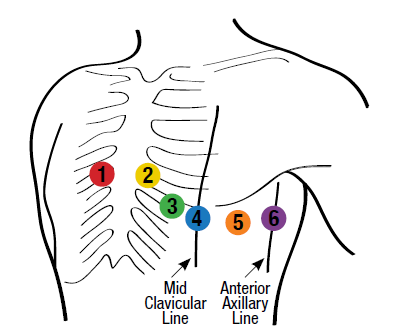 MIDMARK-IQecg-12-Lead-Resting -ECG -02