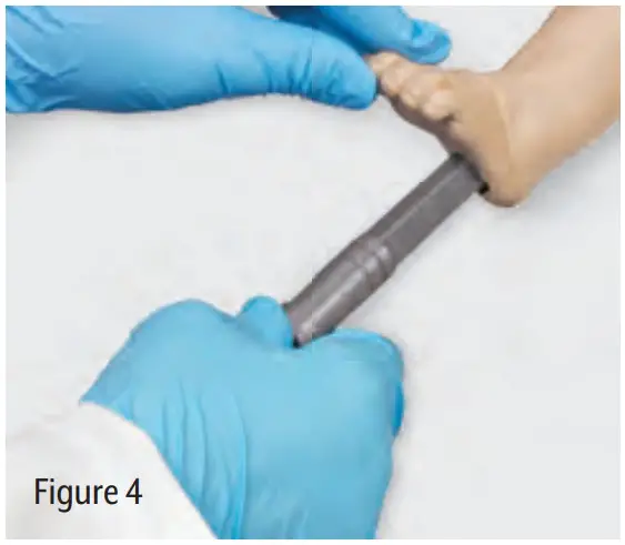 Nasco LF03622U Infant Single Intraosseous Infusion Leg - fig 4