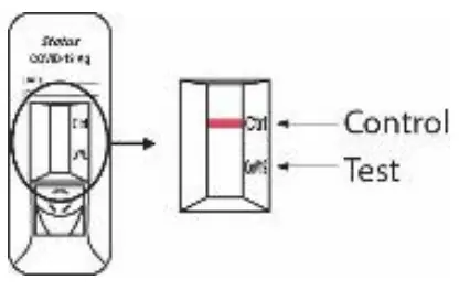 Status 33301 COVID-19 Antigen Rapid Test for Home - figure 11