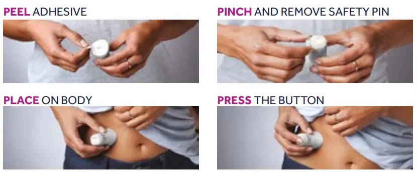 Medtronic MiniMed Mio Advance Infusion Set - fig1