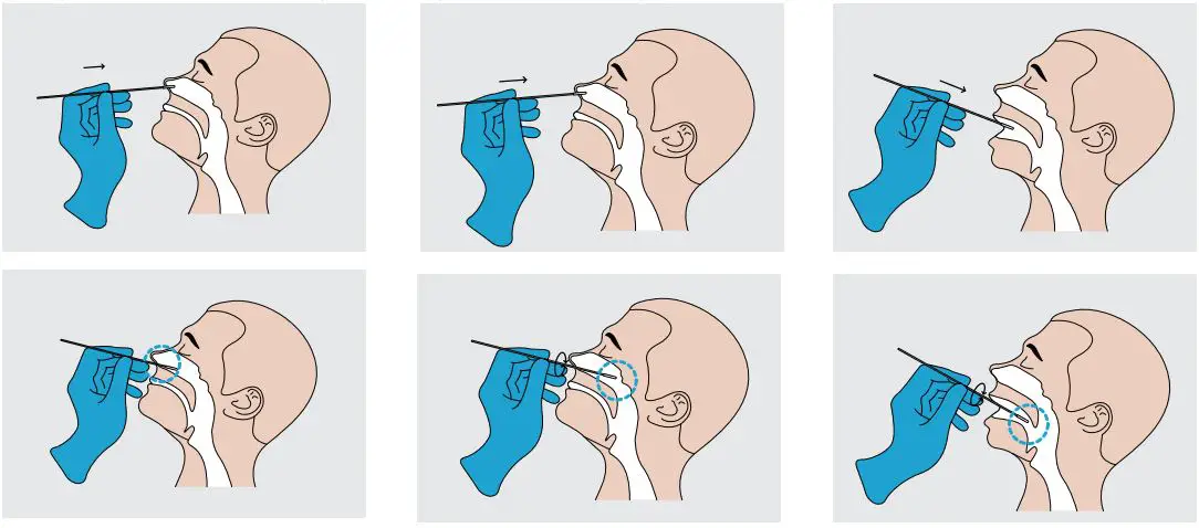 CodaCare-SARS-CoV-2-Antigen-Test-Kit-fig-1
