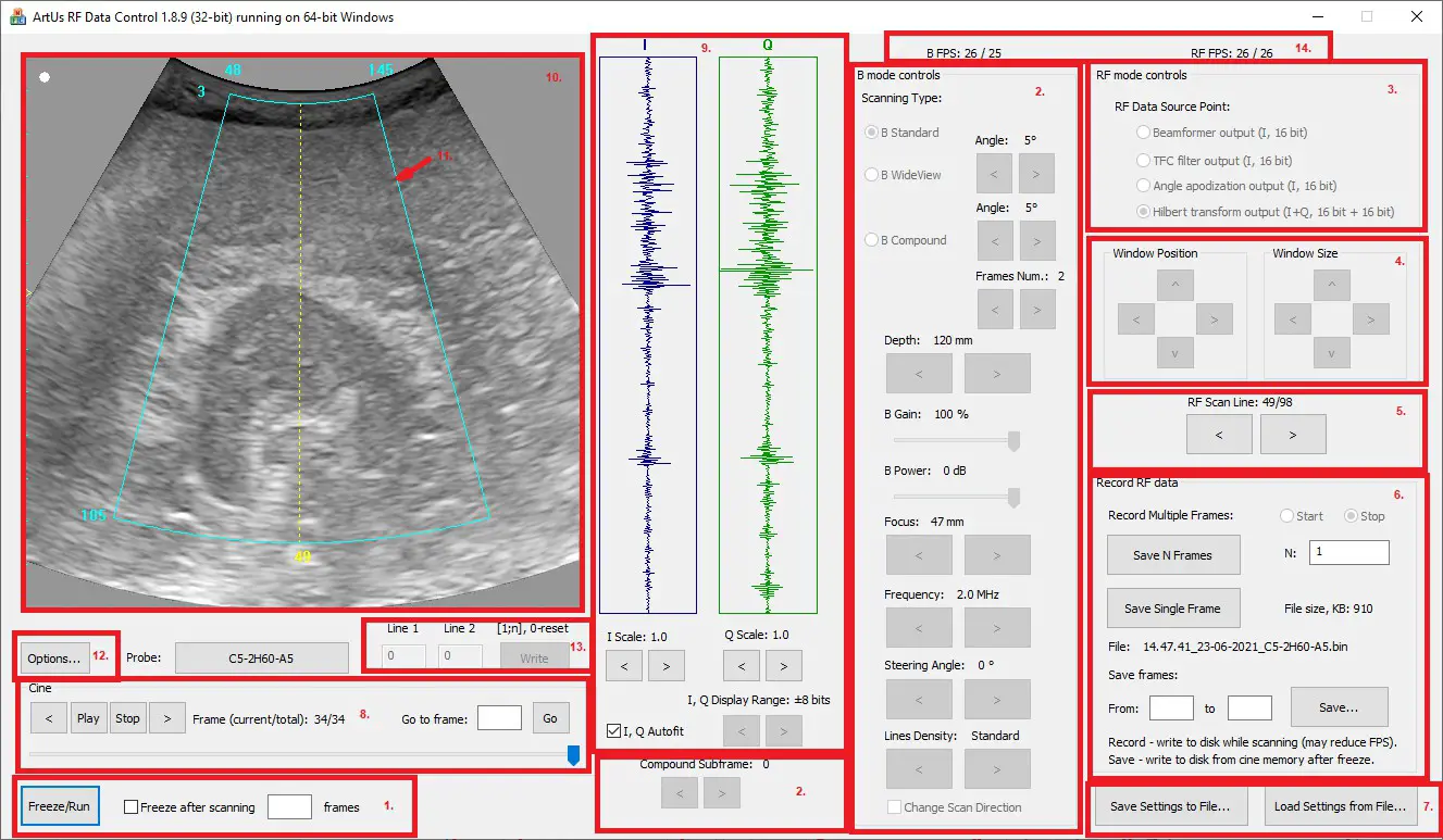 TELEMED ArtUs RF Data Control - Product Overview 1