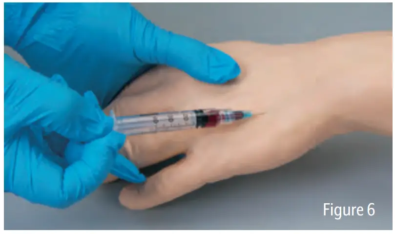 Nasco LF01121U Advanced Injection Arm - Injection and Withdrawal