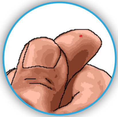 Intuity Medical Inc POGO Automatic Blood Glucose Monitoring System - Supplies for 18