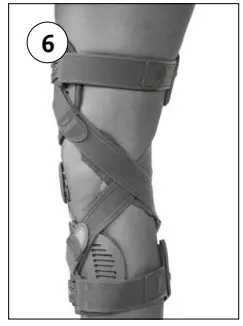 OSSUR-Unloader-One-Smartdosing-Unloader-One-Custom-Smartdosing-FIG-7