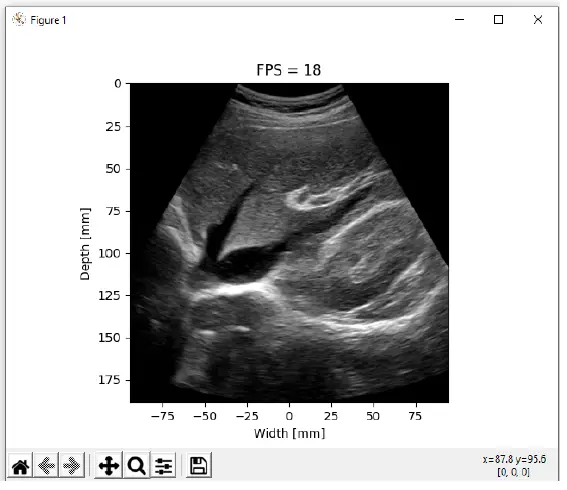TELEMED-Real-Time-Imaging-for-the-Research-fig- (9)