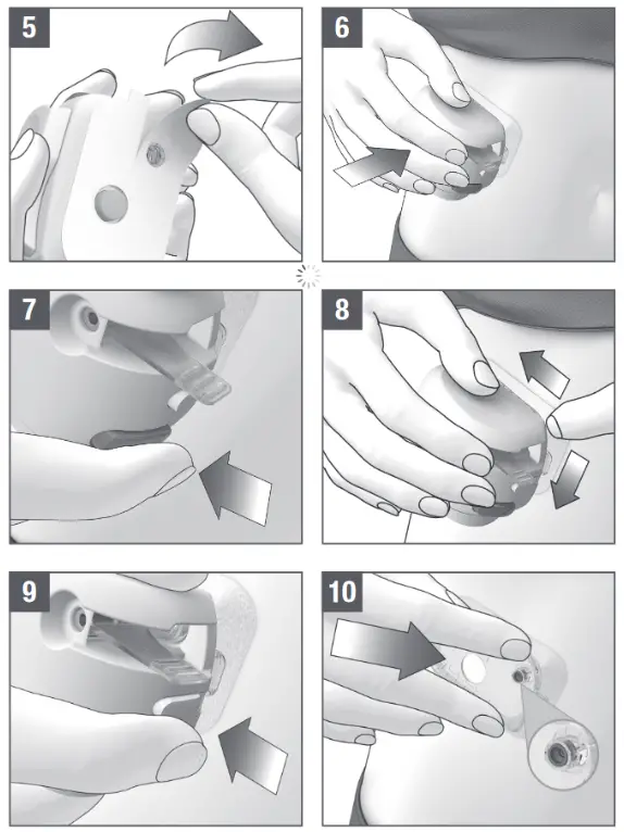 ACCU-CHEK Solo Insertion Device - fig 2
