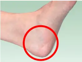 ALCARE Multi Fix-Roll Semi-Permeable Waterproof Film A6