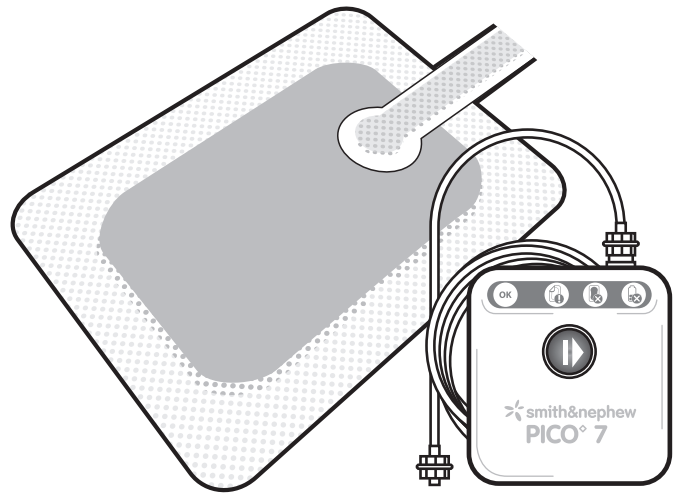 smith nephew PICO 7 Single Use Negative Pressure Wound Therapy System